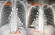 心脏位置医学生表白（一个医学生要怎样去表白）