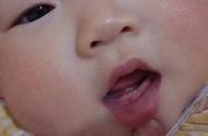 一岁宝宝长两颗牙齿正常吗（一岁宝宝就长了2颗牙齿正常么）
