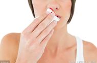 排除鼻咽癌最简单方法（鼻炎和鼻咽癌最大区别是什么）