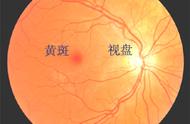 视网膜在眼球什么位置（视网膜在眼睛的哪个部位图片）
