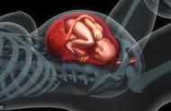 胎儿脐带绕颈一圈怎么办（胎儿绕颈一周图片）