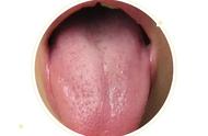 舌头怎么锻炼才能长长（练习舌头伸长的视频）