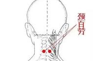 脖部穴的准确位置图（颈部阿是穴的准确位置图）
