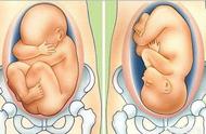 孕8个月胎心在肚脐正下方（孕26周胎心还在肚脐眼下方）