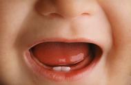 小孩出牙是什么样子的（小孩出牙的症状和规律）