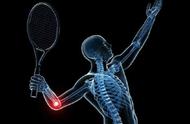 网球肘最快的自愈方法（网球肘怎么治疗才能根除）