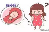 胎停后多久适合再怀孕（怀孕四个月死胎有什么症状）