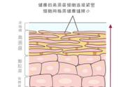 敏感肌去角质小妙招（角质层薄敏感肌教你一招轻松修护）