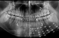 什么样智齿属于正常智齿（什么样的智齿是不正常的）