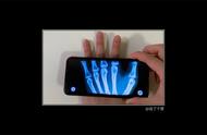 手机扫描骨头的软件（手机扫骨头的软件叫什么）