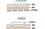 防妊娠纹橄榄油排行榜（预防妊娠纹橄榄油十大牌子）