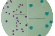 分离霍乱弧菌最常用的培养基是（霍乱弧菌分离培养常用培养基）