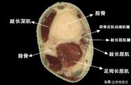 灸三阴交的神奇作用（三阴交什么时候灸效果最好）