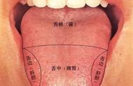 正常人舌头图片（萎缩性胃炎舌头图片）