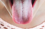 舌头分为几种形状（舌头都有什么形状图片）