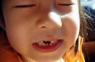 5岁换牙是不是太早了（5岁半换牙属不属于早熟）