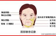 长得显老如何解决（18岁长得显老怎么补救）