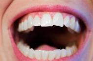 牙黄变白最实用的方法（冷光美白一般多少钱）