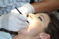 牙本质敏感处理方法（严重牙敏感最好的解决方法）
