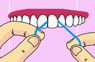 牙线会使牙缝变大吗（牙线多久用一次）