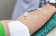 献血浆对人有害吗（长期献血浆有坏处吗）