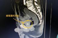 打了牙往肚里咽（把牙咽进肚里怎么办）