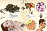 腺鼠疫跟鼠疫（传统的鼠疫称为腺鼠疫）