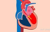心瓣膜关闭不全能活多久（心脏瓣膜关闭不全能存活几年）