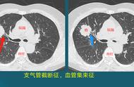 活的时间最长的癌症排名