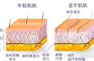 为什么除皱效果最好（除皱什么方法效果好没有后遗症）