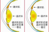 儿童近视了经常戴眼镜好吗（儿童近视后要一直戴眼镜吗）