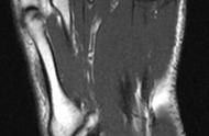 女性左脚疼痛部位图解图片（左脚穴位图）