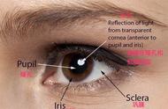眼睛各个部位名称图解（眼睛各部位名称及作用）
