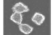 用荧光显微镜检测细胞凋亡方法（列举检测细胞凋亡的五种实验方法）
