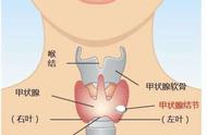 碘131后多长时间可以备孕（碘131治疗后有怀孕成功的吗）