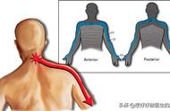 颈椎压迫肩膀疼挂哪个科（颈椎痛肩膀疼挂什么科）
