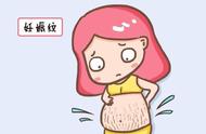 妊娠纹怎么去掉最好（妊娠纹怎么去除最好）