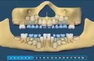 儿童长牙顺序图（最完整的儿童长牙顺序图家长必看）