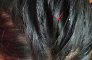 干性发质头发为啥会变油（以前的头发变成油性发质了怎么办）