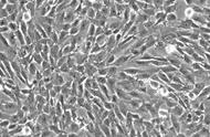 脱落细胞常用的细胞染色方法（常用的五种细胞化学染色方法）