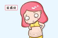 怀孕三个月了肚子有点痒（怀孕三个月肚子有点微微痛正常吗）
