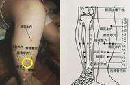 为什么四花中四花外是万能穴（四花上穴和四花下穴怎么进针）