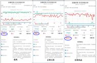 车子怠速情况下抖动是怎么回事（车子怠速时有抖动感是什么原因）