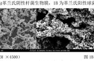 白细胞吞噬细菌生物膜有什么作用（白细胞吞噬细菌会出现什么现象）