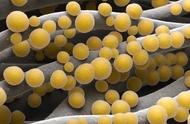 如何预防感染金黄色葡萄球菌（金黄色葡萄球菌是是怎么感染的）