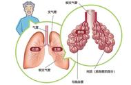 肺间质是哪些结构（肺间质是哪里图示）