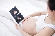 孕早期怎么样度过（孕早期最佳状态）