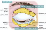 眼窝凹陷怎么恢复图解（眼窝凹陷怎么恢复饱满效果最好）