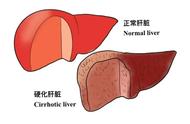 什么是乙肝低病毒血症（乙肝低病毒血症很严重吗）