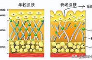 防止脸下垂的最好方法（一边脸正常一边下垂）